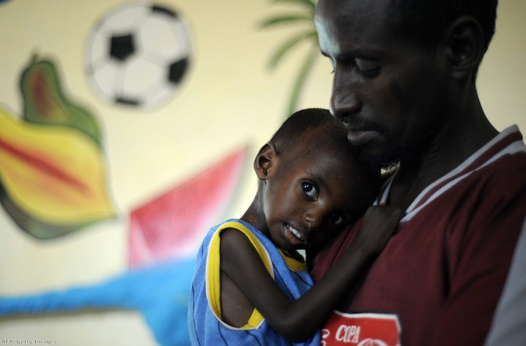 Aden, a three-year-old Somali refugee, recovers at a stabilisation centre after arriving on the verge of death from severe malnutrition